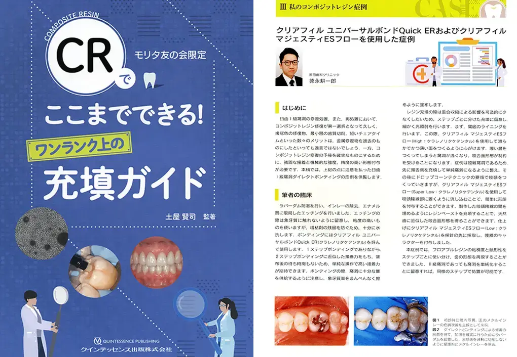 CRでここまでできる