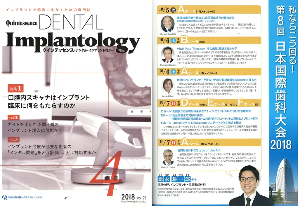 デンタルインプラントロジー