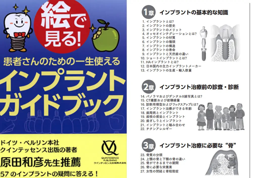 インプラントガイドブック