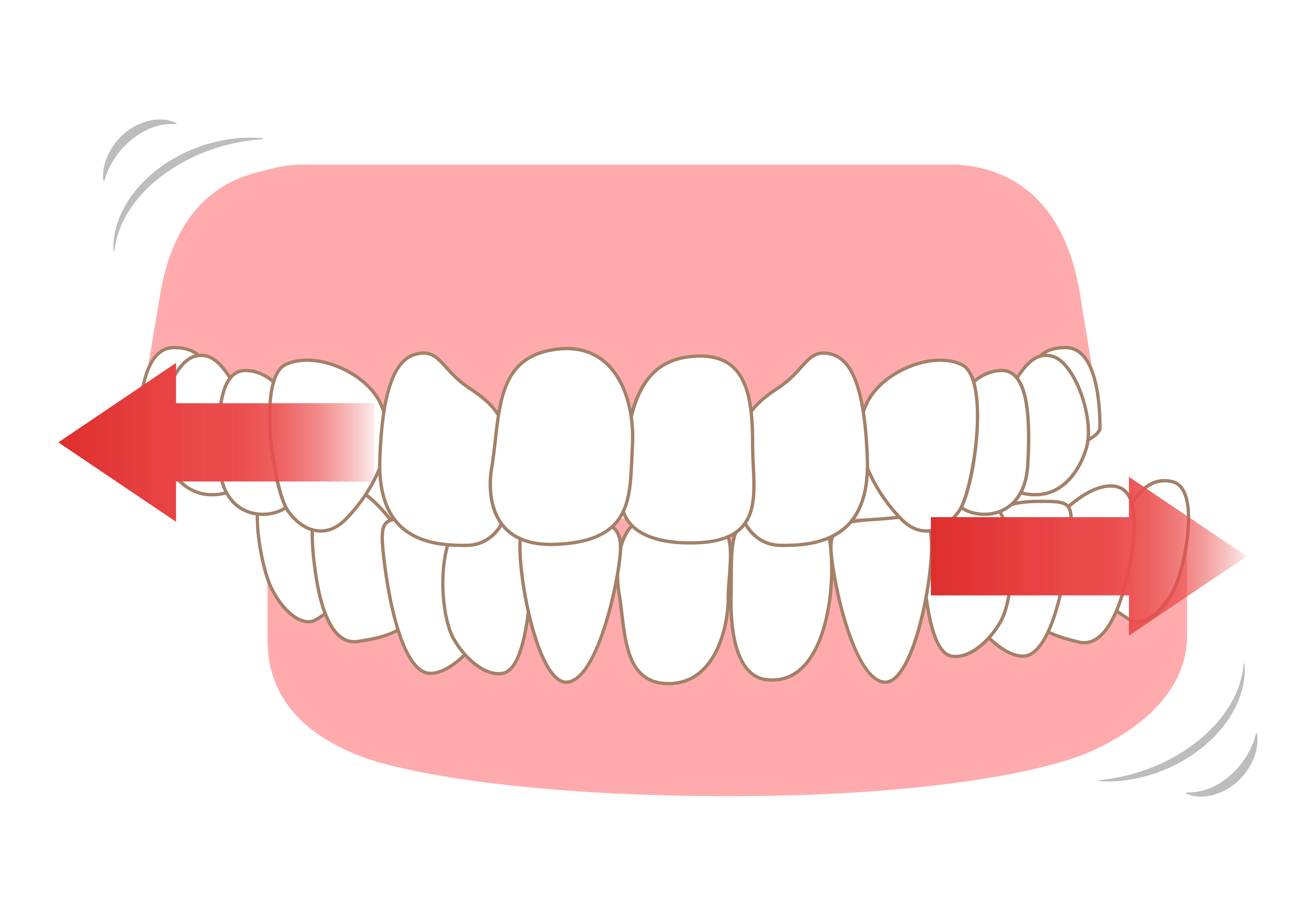 グラインディング